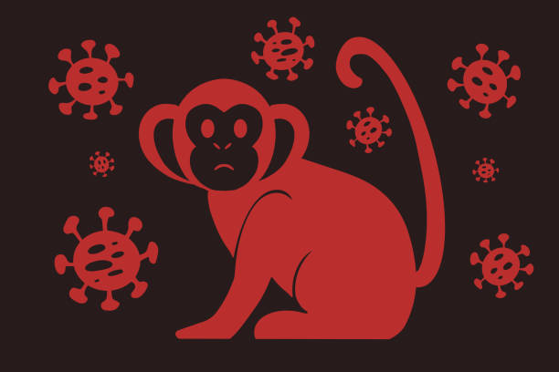 En Yucatán son 72 casos de viruela del mono