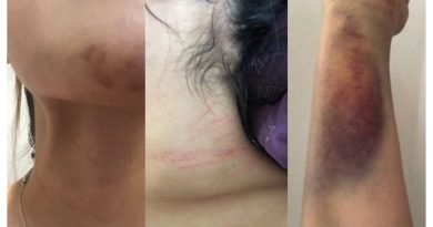 Naomi suplica que no dejen libre al hombre que intentó matarla