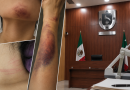 Liberan al agresor de Naomi pese a antecedente de fuga